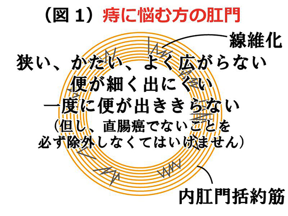 痔に悩む方の肛門