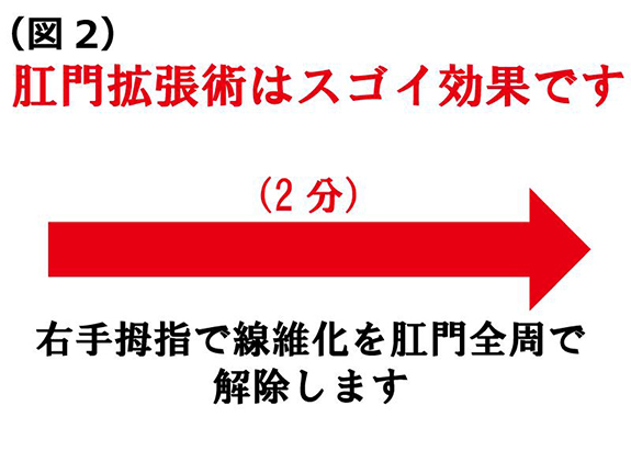 肛門拡張術はスゴイ効果です