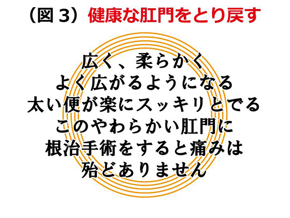 健康な肛門をとり戻す